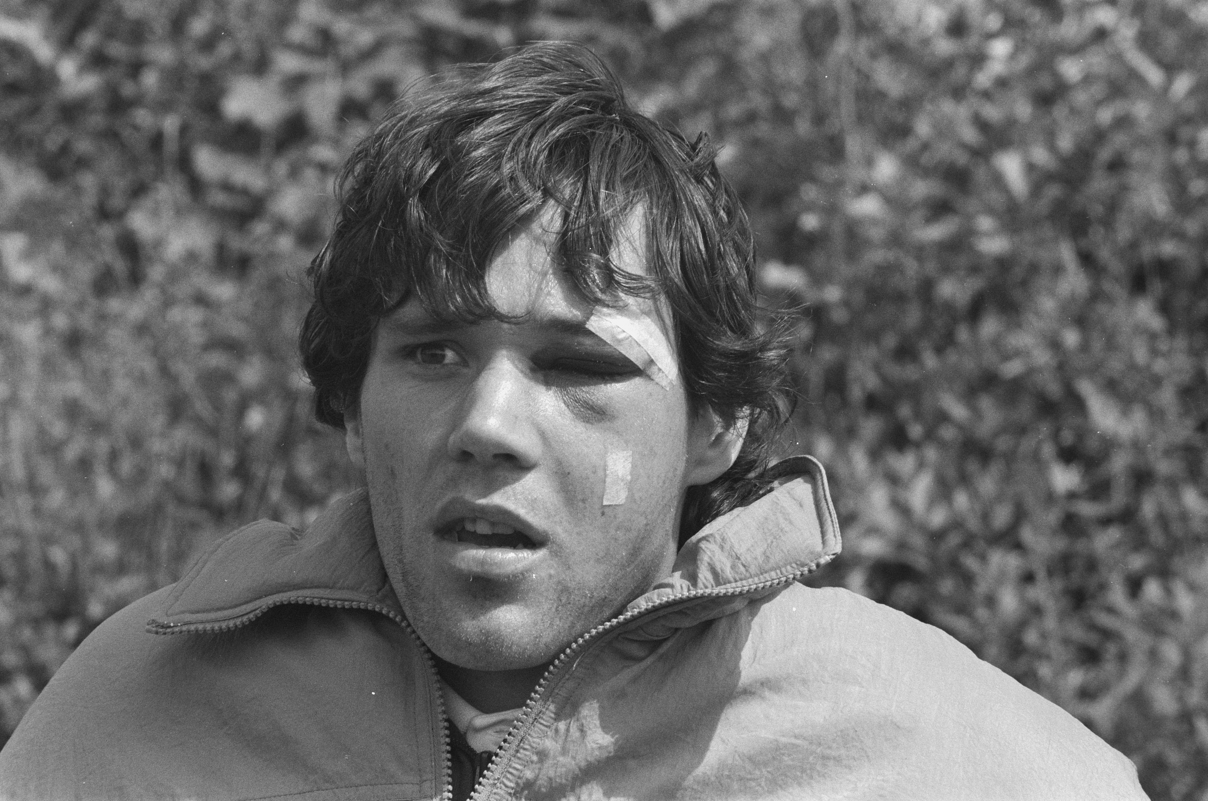 Black-and-white close-up of Marco van Basten with tape above his left eye during Netherlands training in 1988.